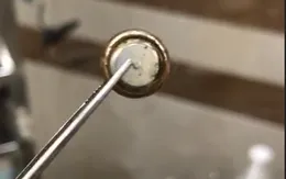Bé trai suýt hoại tử mũi vì pin cúc áo
