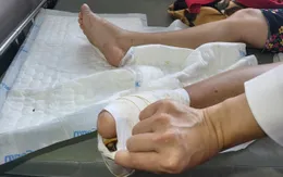 Các biến chứng nguy hiểm của bệnh đái tháo đường type 2