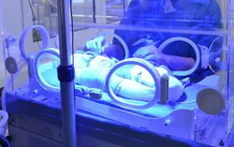 Sinh non - Những điều cần biết