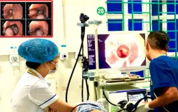 Cấp cứu bệnh nhân xuất huyết tiêu hóa nặng do vỡ tĩnh mạch thực quản