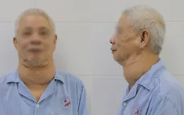 Bóc khối u khổng lồ chèn ép đường thở bệnh nhân cao tuổi