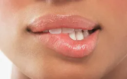 Những đốm đen xuất hiện trên môi có ý nghĩa gì?