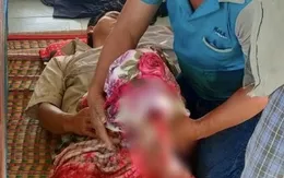 Cà Mau: Hỗ trợ cấp cứu kịp thời một ngư dân gặp nạn trên biển