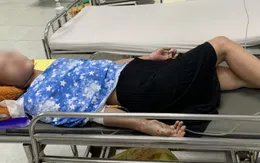 Nổ bình gas khi đang nấu ăn, 2 người bị bỏng nặng