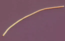 Vi khuẩn lớn nhất thế giới khiến các nhà khoa học kinh ngạc vì "quá phức tạp"