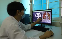 Tăng cường khám và điều trị di chứng hậu COVID-19