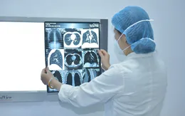 Khám hậu COVID-19 lần đầu, bệnh nhân phát hiện rối loạn đông máu, tổn thương phổi