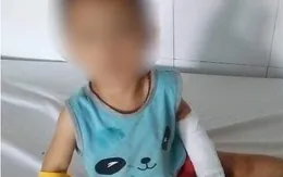 Cắt gân tay cháu bé 3 tuổi để dằn mặt người tình