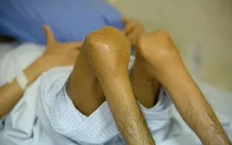 Điều trị dự phòng chảy máu: Tương lai cho người có hemophilia