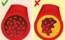 Uống cà phê decaf có thể gây hại đến sức khỏe như thế nào?