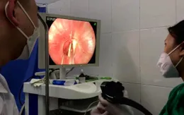 Gắp mảnh xương gà cắm vào thực quản bệnh nhân