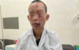 Nam thanh niên bị cháy sém toàn thân, mất thị lực do dùng điện thoại khi đang sạc