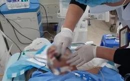Chủ quan với vết thương nhỏ, nam thanh niên mắc uốn ván nguy kịch