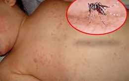 Bé trai 12 tuổi tử vong do mắc sốt xuất huyết tại Đắk Lắk
