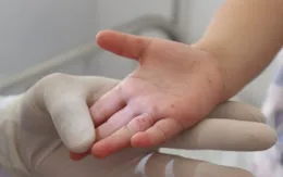 Chủ động phòng bệnh tay chân miệng