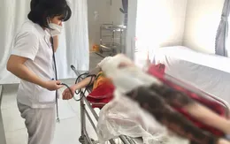 Cảnh báo tự ý bôi thuốc nam khi bị bỏng