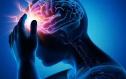 Nữ bệnh nhân bị liệt nửa người do viêm não virus