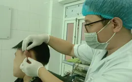 Áp xe vành tai do sở thích xỏ khuyên