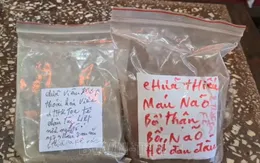 Viêm dạ dày cấp tính nghi do uống thuốc nam chữa đau xương khớp