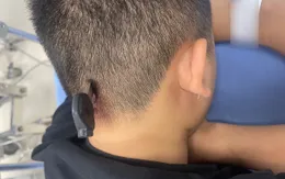 Cấp cứu nam thanh niên bị chìa khóa... cắm vào đầu