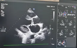 Cảnh báo: Hiểm hoạ tim mạch khôn lường vì tiêm thuốc giảm đau vào khớp tại phòng khám tư nhân