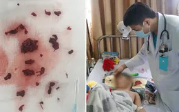 Bé mới 4 tuổi đã bị đột quỵ não, bác sĩ cảnh báo thực trạng đáng lo ngại