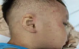 Cấp cứu bé trai 3 tuổi nghi bị bạo hành, nhốt trong tủ cấp đông