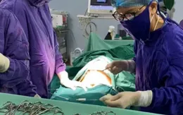 Hy hữu: Cấp cứu bệnh nhân chửa ngoài tử cung ở... đại tràng