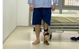 Kỳ tích mới: Kéo dài chân tới... 18 cm cho chàng trai mắc dị tật chân cao chân thấp