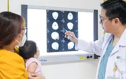 Thắp lên hy vọng cho bé gái 10 tháng tuổi mắc dị tật sọ mặt hiếm gặp