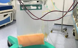 Cứu sống nữ bệnh nhân có huyết tương trắng đục như sữa