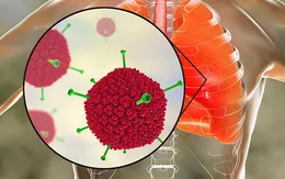 Virus Adeno mà nhiều trẻ đang nhiễm phải nguy hiểm ra sao?