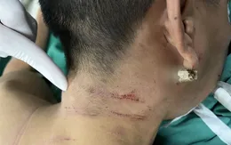 Đi xe máy ngã vào bờ rào, nam thanh niên bị cành tre đâm xuyên cổ
