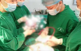 Đau bụng âm ỉ suốt 3 tháng, đi khám phát hiện khối u buồng trứng nặng 3 kg