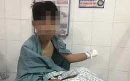 Cảnh báo tai nạn do sử dụng pháo nổ dịp Tết gây nhiều hậu quả đáng tiếc