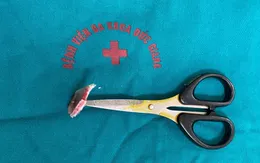 Chơi đùa cùng bạn học, bé 12 tuổi bị kéo đâm thủng hộp sọ