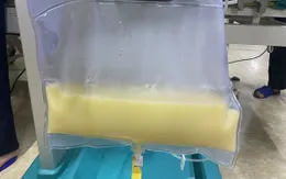 Nhập viện ngày cuối năm vì máu trắng đục như sữa