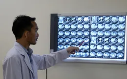 Sút cân không rõ nguyên nhân, đi khám phát hiện mắc ung thư đại tràng