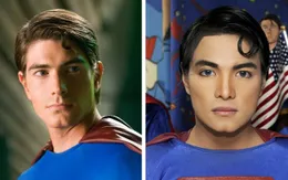 7 trường hợp người hâm mộ mạnh tay chi "tiền tỷ" để phẫu thuật giống thần tượng