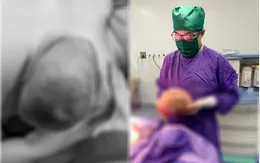 Bóc tách khối u vú nặng 3kg cho nữ bệnh nhân