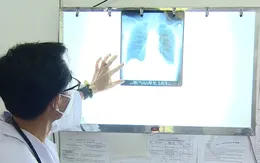 70% bệnh nhân lao là người nghèo