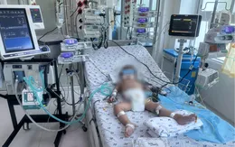 Cứu sống bệnh nhi sốc sốt xuất huyết suy hô hấp, tổn thương gan nặng