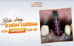Nha khoa Nikko chỉ ra nguy hại khôn lường của implant giá rẻ