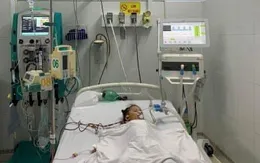 Lọc máu liên tục cứu sống bé gái mắc tay chân miệng nặng