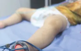 Cảnh báo trẻ ngộ độc thuốc và hóa chất tại nhà