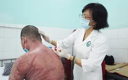 Mua thuốc trôi nổi, bệnh nhân vảy nến bị biến chứng nặng