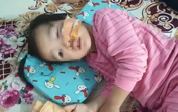 Bé gái 3 tuổi bị chó becgie nhà hàng xóm cắn, phải khâu 16 mũi