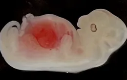 Các nhà khoa học đã “nuôi cấy thận” trong phôi lợn như thế nào?