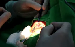 Sở Y tế TP. Hồ Chí Minh thông tin về phản ánh của người bệnh bị giảm thị lực sau phẫu thuật