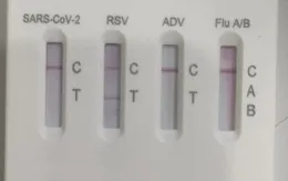 Gia tăng trẻ nhập viện do nhiễm virus hợp bào hô hấp